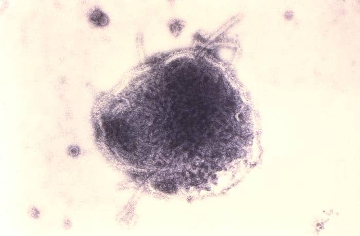Sudah pernah campak, apakah bisa terinfeksi lagi?