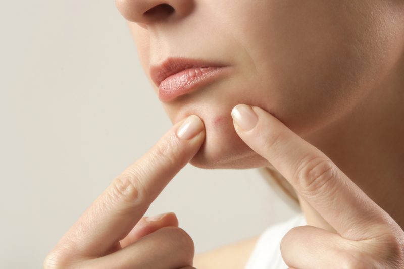 Kulit jadi lebih sensitif sebelum menstruasi? Ini penyebab dan cara mengatasinya!